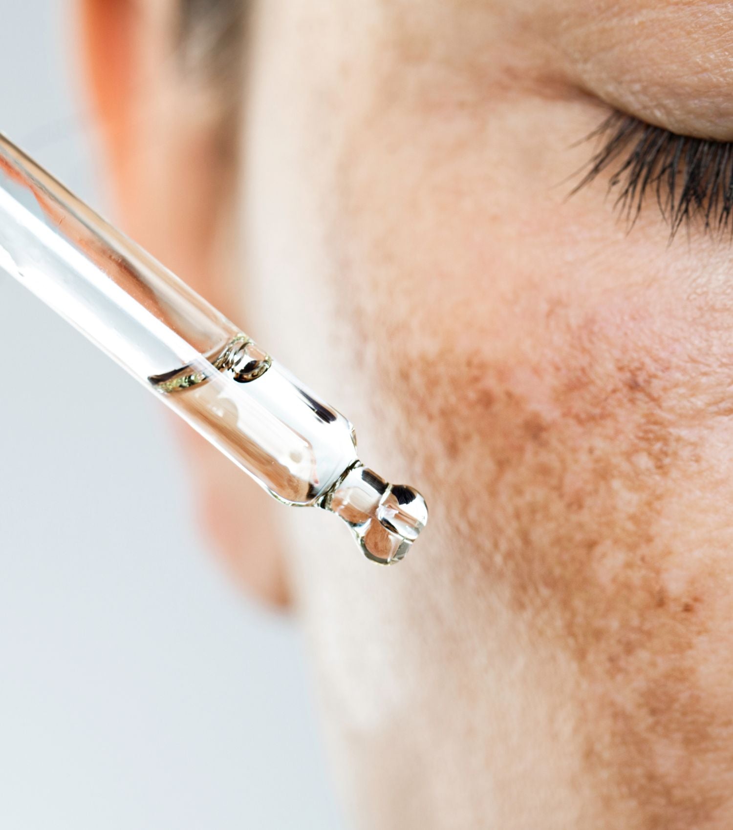 Пигментация